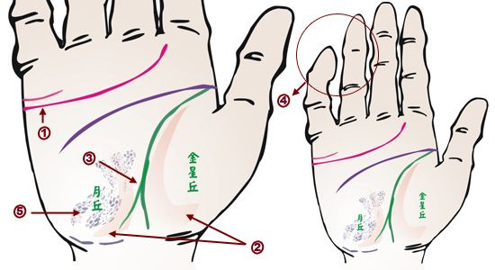 手相看病图解