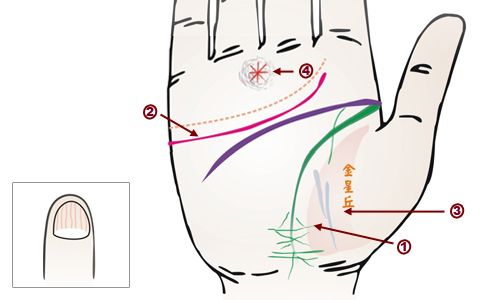 手相看病图解