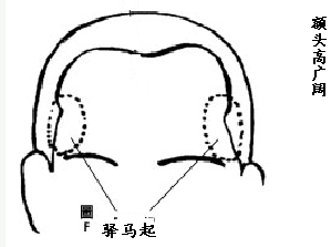 面相额头看相图解